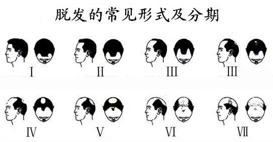      ѷЩ