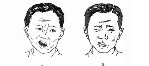 福州较好的皮肤病研究院-脸部受风处理简单方法